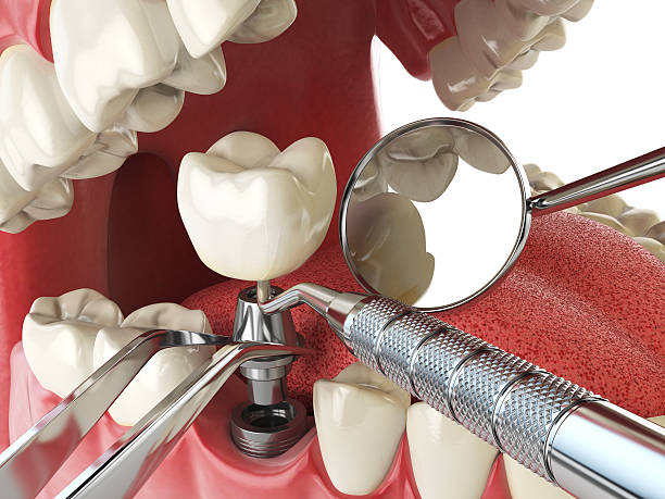 Best Emergency Treatment for Dental Infections or Abscesses in Smithville, MO
